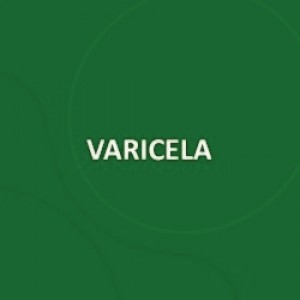 VACINA VARICELA